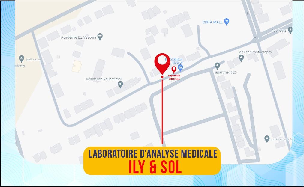 774 Logements participatifs, précisément au bâtiment 25, locale 22B à EL KHEROUB, Ali Mendjeli Constantine